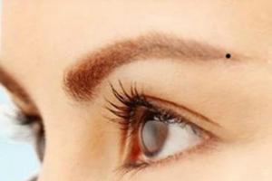 Nốt ruồi ở những vị trí này là nơi dễ kiếm tiền nhất, và đều ẩn chứa những điều bí ẩn